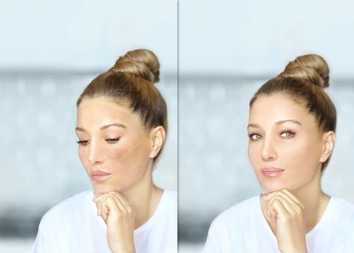 Aging & Sun-Damaged Skin