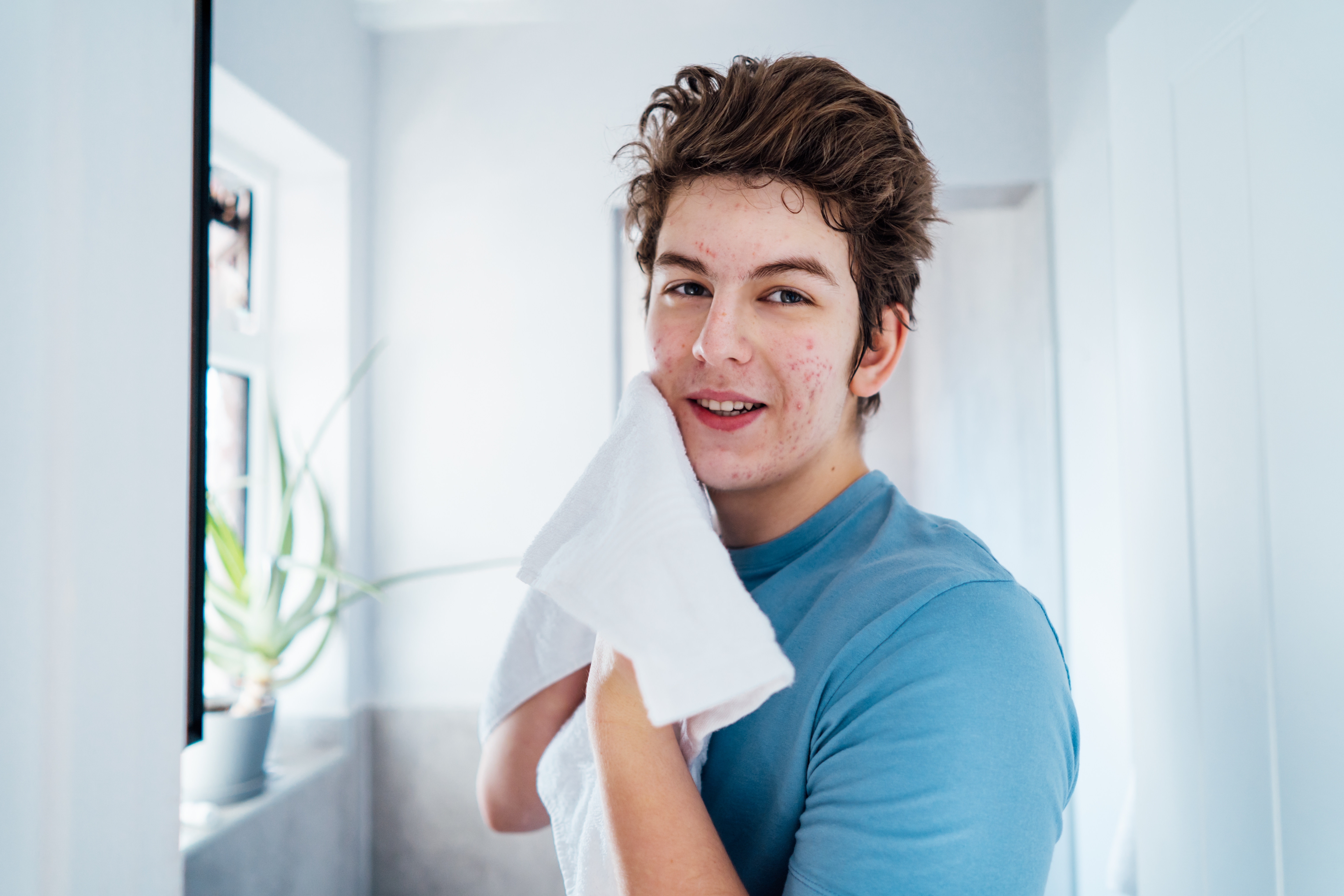 Acne-Prone Skin